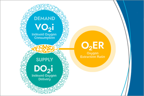 Managing Supply and Demand