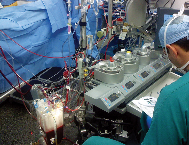 Goal Directed Perfusion-Techniques for Reducing AKI and Post-operative Delirium